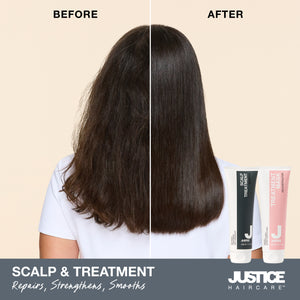 Scalp Treatment Shampoo - 250ml