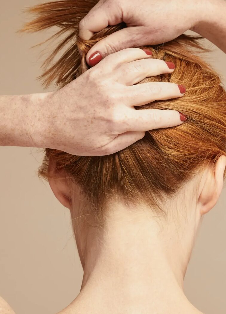 Scalp imbalance